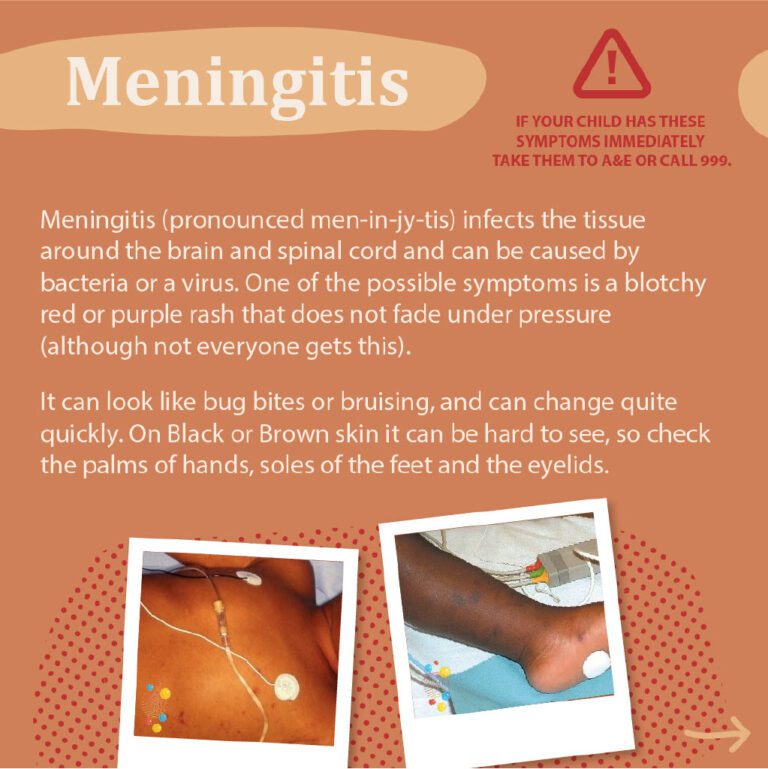 Meningitis